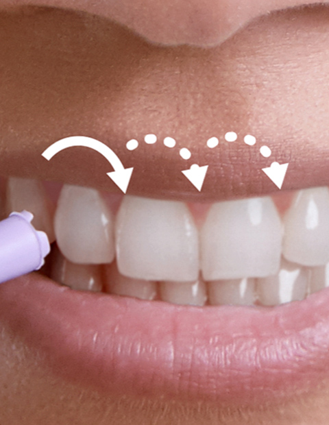 &bdquo;Pulse Wave&ldquo; technologija